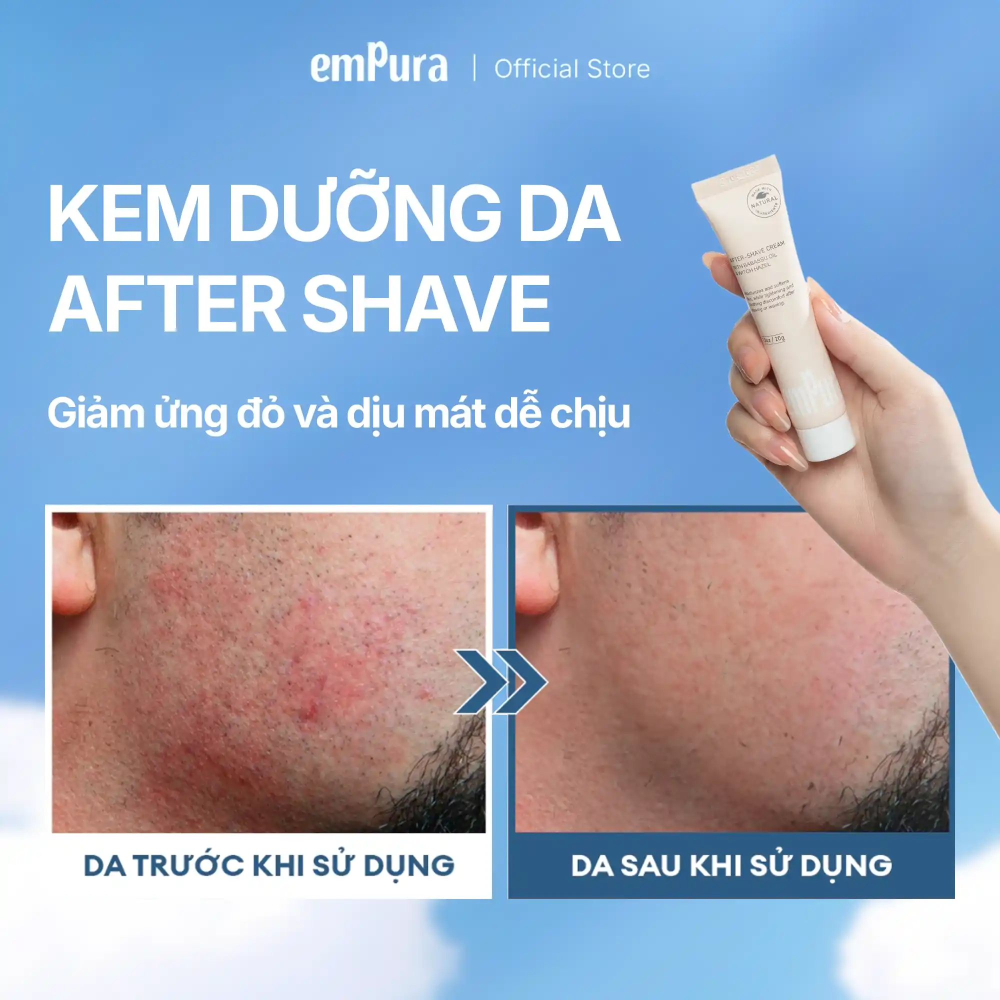 Kem dưỡng sau cạo/wax lông vùng kín empura