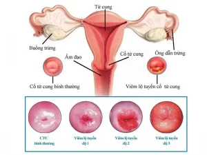 âm đạo vùng kín